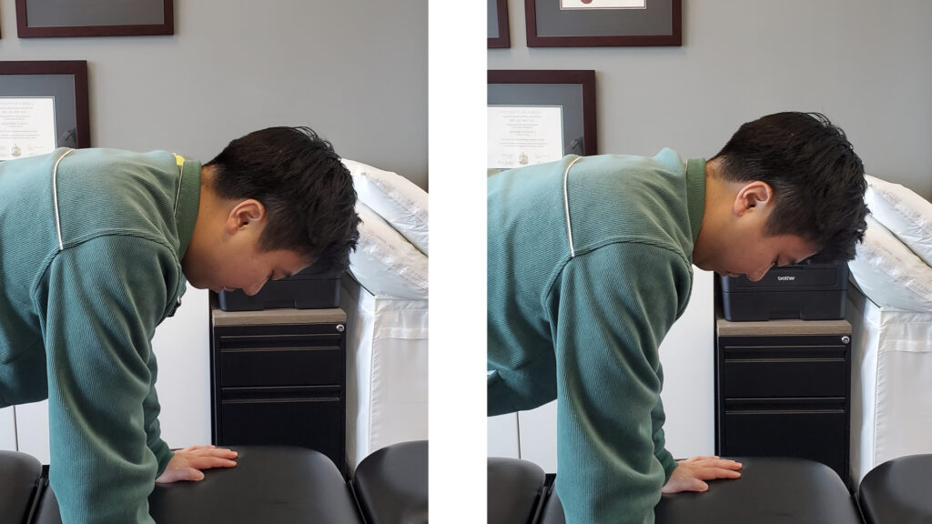 Herniated Disc or Bulging Disc in the Neck - Physiotherapy Toronto