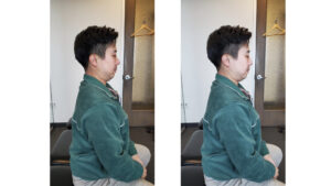Physiotherapist Bryan Chen demonstrating a seated chin retraction exercise to treat a herniated disc or bulging disc in the neck